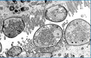 Cryptosporidium Parvum